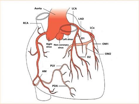 plv artery location